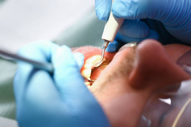 Best Emergency Denture Repair in Reiffton, PA